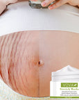 Anti - Stretch Marks Scar Removal Cream - LUNA