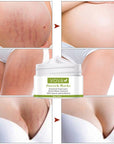 Anti - Stretch Marks Scar Removal Cream - LUNA