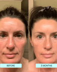 NANO SKIN™ FACE REJUVENATION ANTI AGING FORMULA COLLAGEN FILMS - LUNA