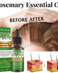 Rosemary Anti - Breakage Nourishing Hair Care Oil (Free with Therapy Brush) - LUNA