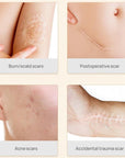The Anti - Stretch Mark Serum - LUNA