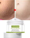 Anti - Stretch Marks Scar Removal Cream - LUNA