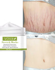 Anti - Stretch Marks Scar Removal Cream - LUNA
