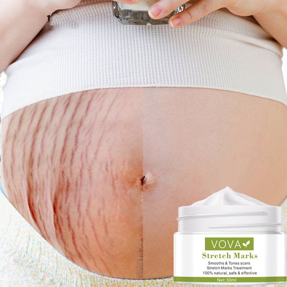Anti - Stretch Marks Scar Removal Cream - LUNA