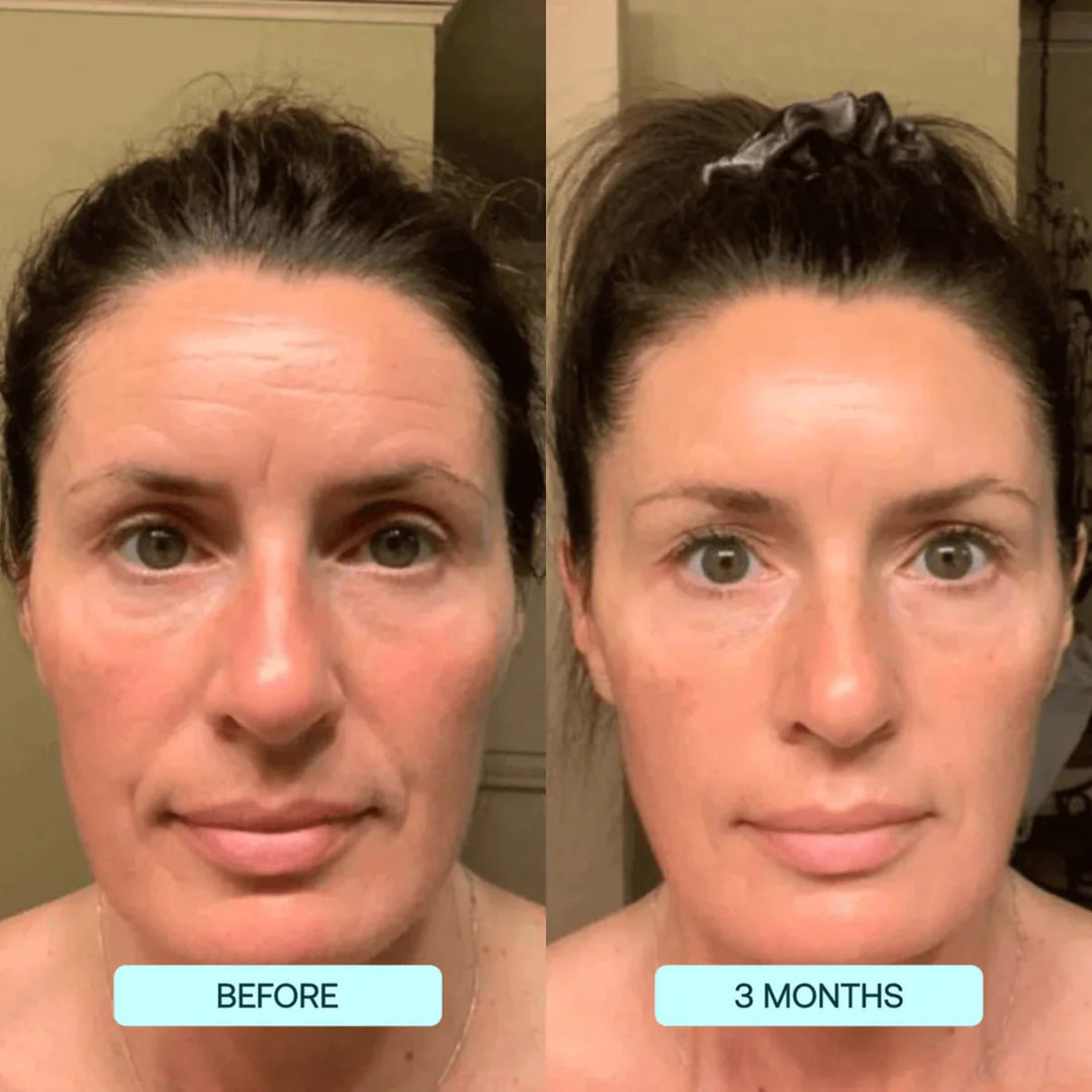 NANO SKIN™ FACE REJUVENATION ANTI AGING FORMULA COLLAGEN FILMS - LUNA