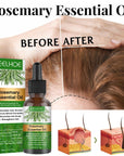 Rosemary Anti-Breakage Nourishing Hair Care Oil - LUNA